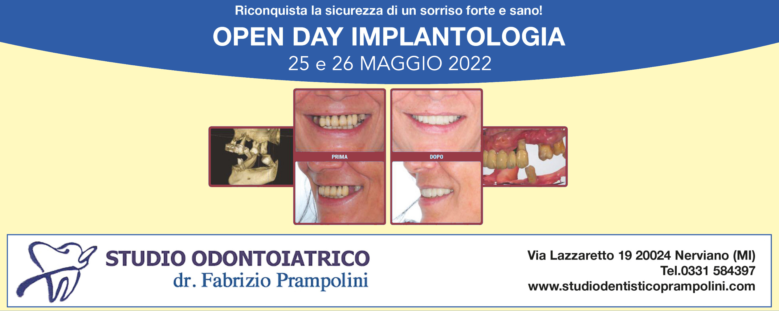 openday implantologia dentista prampolini
